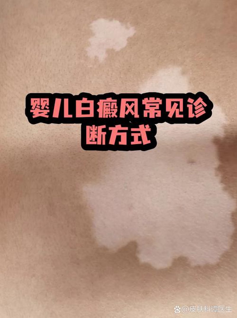武汉白癜风治疗现状与未来趋势
